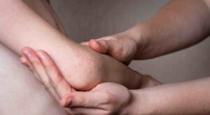 psoriazis
