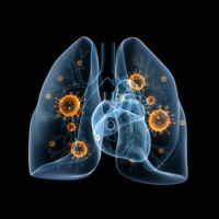 fibroza_chistica