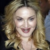 Madonna si-a imbracat dintii in aur