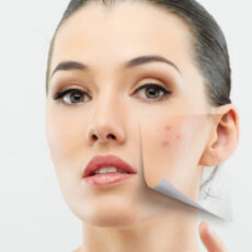 Dermodex: parazitul microscopic care traieste pe fata