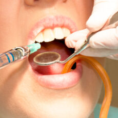 Abcesul dentar, tratat natural