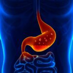 Tulburarile digestive si tratamentele pe baza de plante