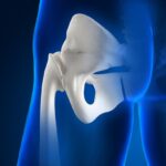 Depunerile de calciu: cauze si tratament