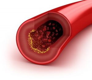 Tratamente Naturiste Pentru Scaderea Colesterolului Tonica Ro