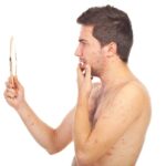 Ten uscat sau acneic? Afla remediile naturiste comune!