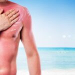 Dr. Dana Opris, medic specialist dermatolog: „Expunerea necontrolata la soare fara o protectie solara adecvata presupune riscuri mari”