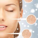 Cum prevenim agravarea bolilor dermatologice in sezonul rece?