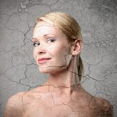Cum prevenim agravarea bolilor dermatologice in sezonul rece?