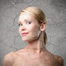 Cum prevenim agravarea bolilor dermatologice in sezonul rece?