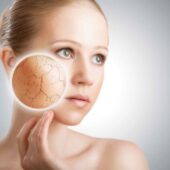 ten deshidratat