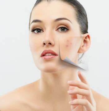 Imperfectiunile pielii si rezolvarile lor: solutii pentru un ten fara acnee, puncte negre si pori dilatati