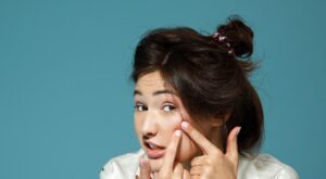 Remedii rapide pentru ameliorarea acneei: de ce apare si cum luptam impotriva acestei afectiuni