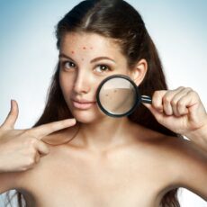 Remedii naturale care combat cosurile