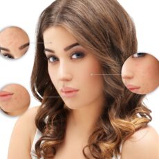 Semnele carentelor de vitamine si minerale pe piele: tu ce vezi cand te privesti in oglinda?
