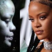 Rihanna, plină de vânătăi pe față. Află care sunt motivele