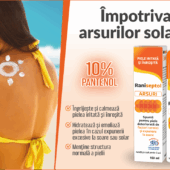 Cele mai bune remedii pentru arsurile solare