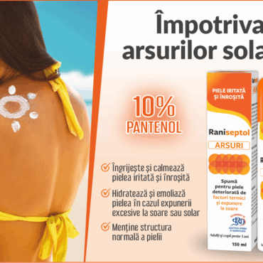 Cele mai bune remedii pentru arsurile solare