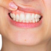 Ce boli trădează culoarea gingiilor