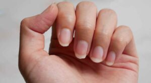 Unghii îngălbenite