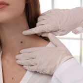 aluniţele