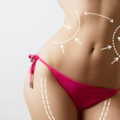 Lipoaspirația asistată laser: Inovație în estetica corporală, cu rezultate permanente