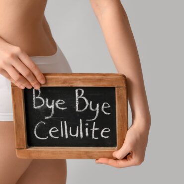 Cum scăpam de celulită? Află de la un nutriționist și instructor de pilates