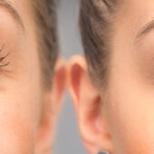 blefaroplastie