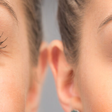 blefaroplastie