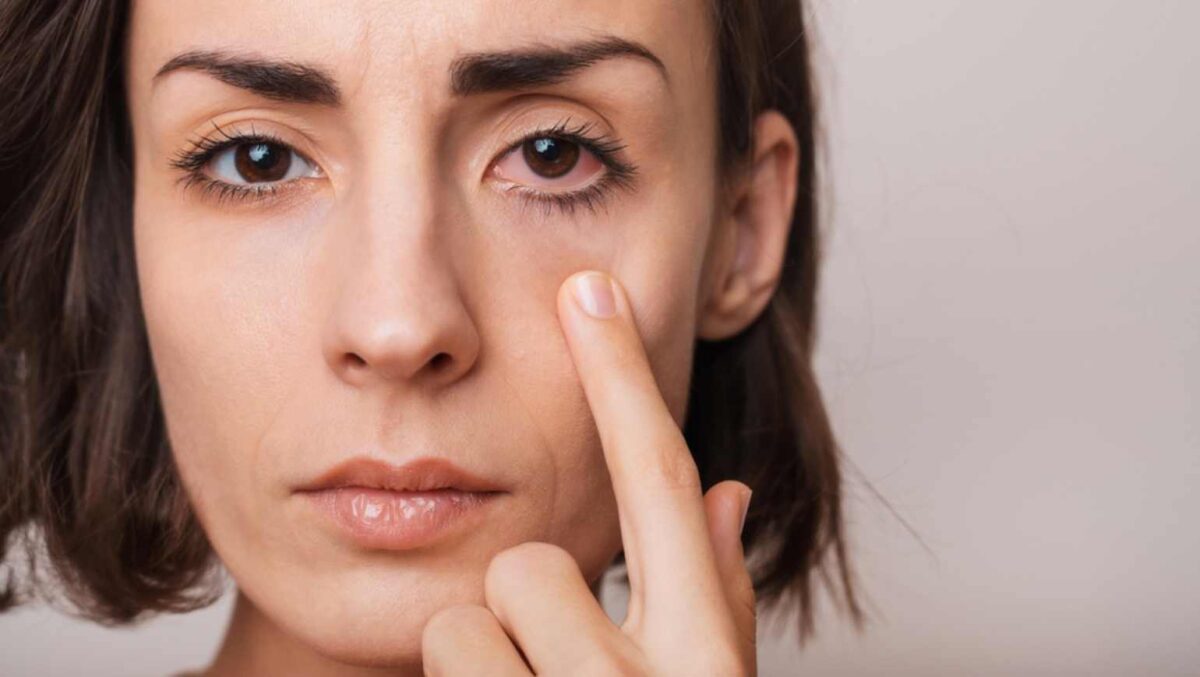purtarea incorectă a lentilelor de contact riscuri lentile de contact