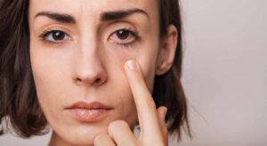 purtarea incorectă a lentilelor de contact riscuri lentile de contact